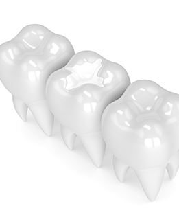 SE Calgary Cosmetic Dentistry | Forest Lane Dental Clinic | Family & General Dentists | SE Calgary