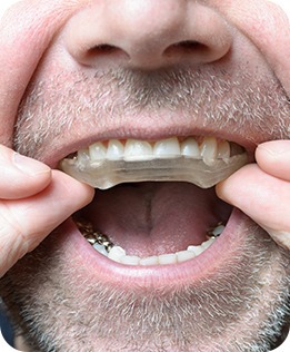 Calgary Night Guards | Forest Lane Dental Clinic | Family & General Dentists | SE Calgary