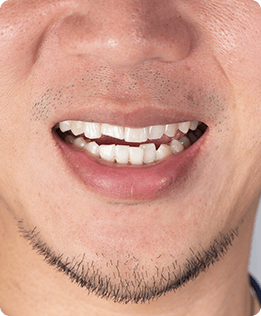Orthodontics | Forest Lane Dental Clinic | Family & General Dentists | SE Calgary