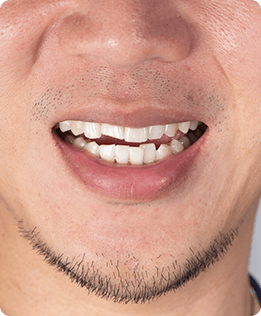 Calgary Orthodontics | Forest Lane Dental Clinic | Family & General Dentists | SE Calgary