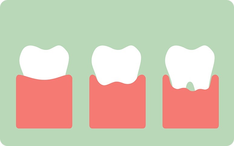 Bad Breath | Forest Lane Dental Clinic | Family & General Dentists | SE Calgary