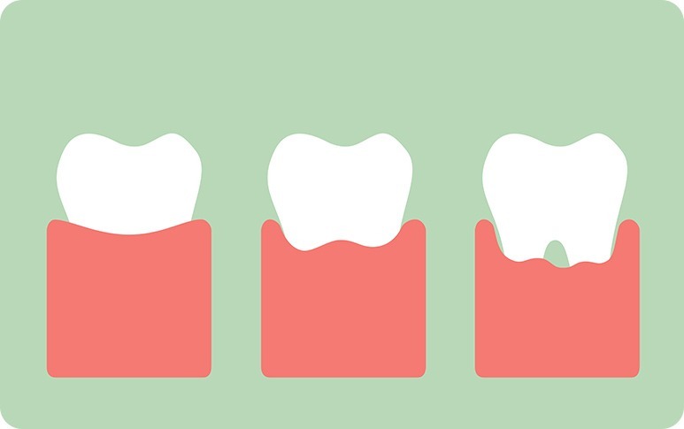 Calgary Bad Breath | Forest Lane Dental Clinic | Family & General Dentists | SE Calgary