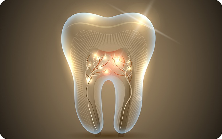 Root Canal Therapy in Burnaby