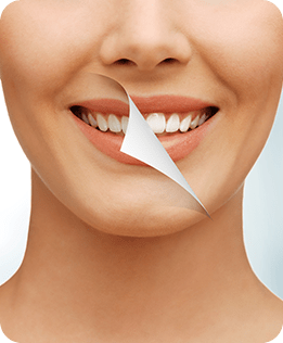 Teeth Whitening | Forest Lane Dental Clinic | Family & General Dentists | SE Calgary
