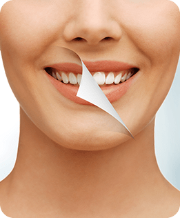 Calgary Teeth Whitening | Forest Lane Dental Clinic | Family & General Dentists | SE Calgary