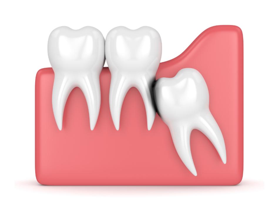 Calgary Oral Surgery