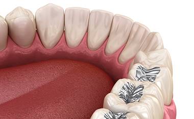 Calgary Restorative Dentistry | Forest Lane Dental Clinic | Family & General Dentists | SE Calgary