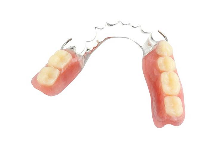 Partial Dentures | Forest Lane Dental Clinic | Family & General Dentists | SE Calgary