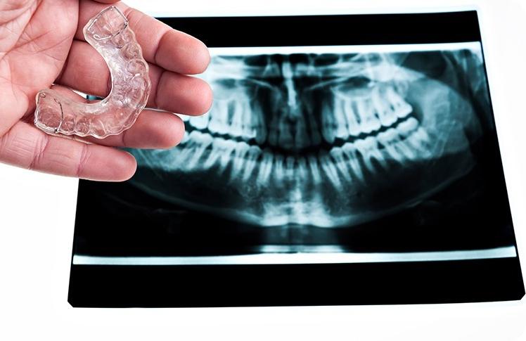 Treatment for TMD | Forest Lane Dental Clinic | Family & General Dentists | SE Calgary